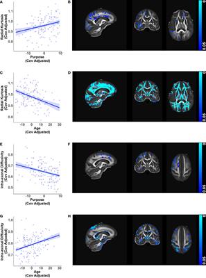 Purpose in life as a resilience factor for brain health: diffusion MRI findings from the Midlife in the U.S. study